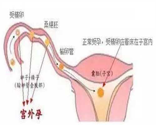 做上海代孕前的检查：代孕8周胃口变好不恶心正