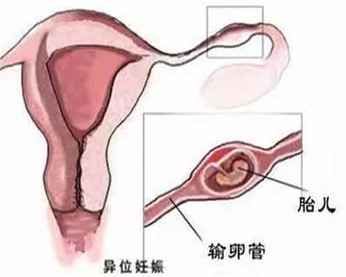 上海代孕成功案例,孕期肚子发痒是怎么回事