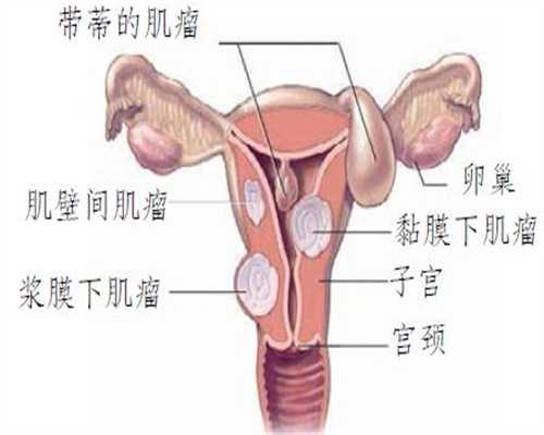 上海捐卵中介,孕妇能吃人参桂圆吗