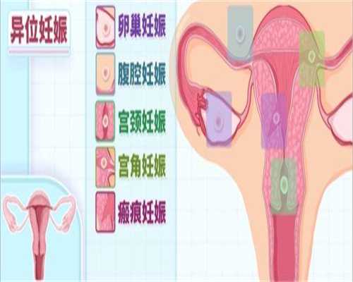上海代孕哪家成功率高,诊断输卵管通而不畅，到