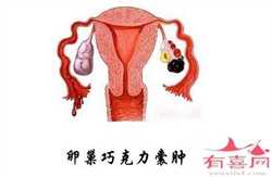 河南省精子库标准,郑州单身女性精子库